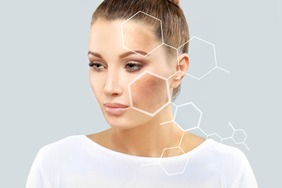 Hyperpigmentation in Mesa, Sun City, Casa Grande, Gold Canyon, & Chandler, AZ