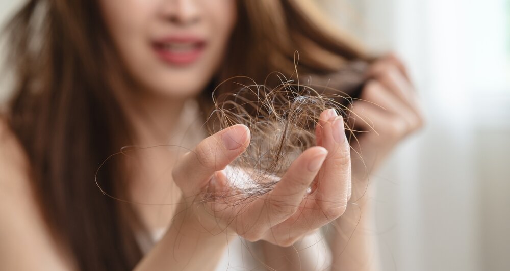 Hair Loss (Alopecia)